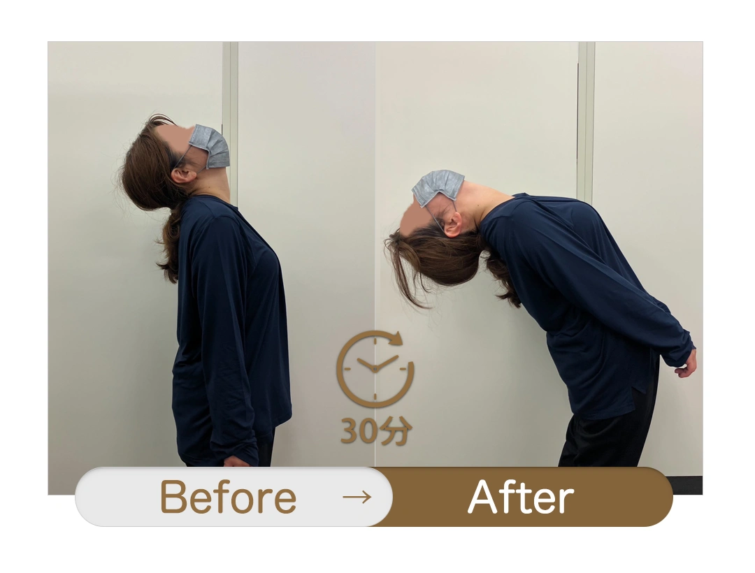 もみほぐし【肩こり/腰痛改善】リラクボディのビフォーアフター