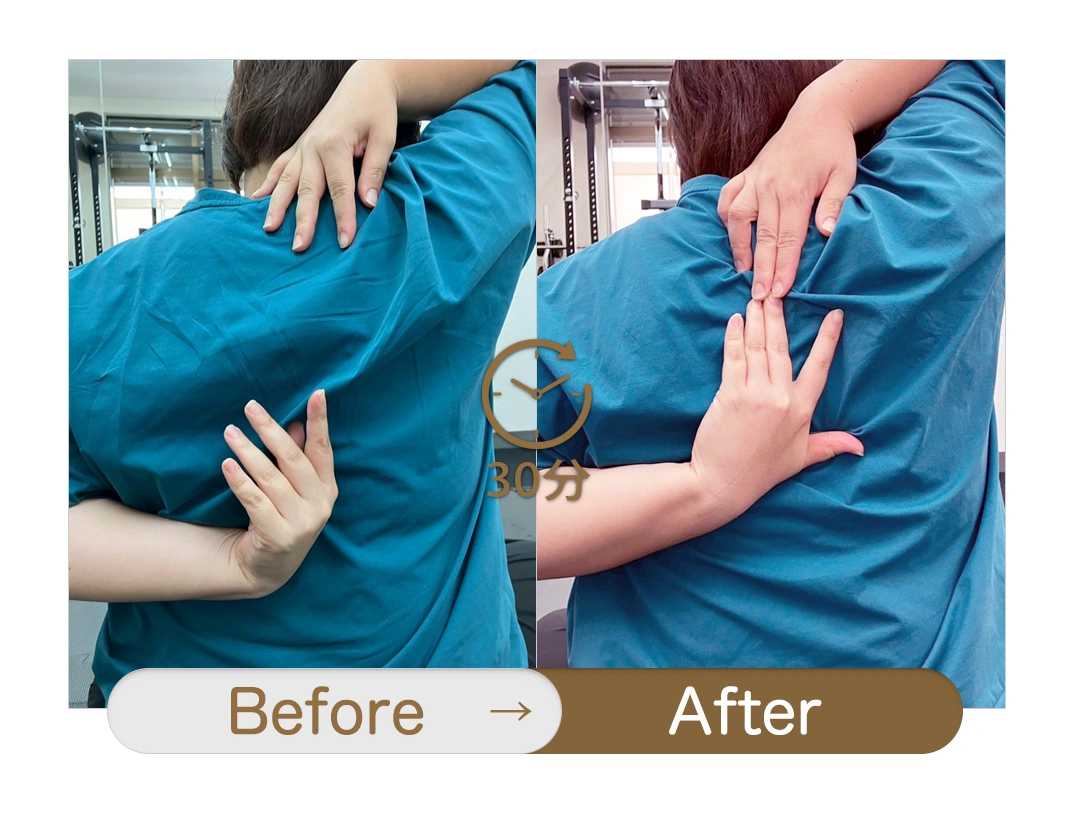 もみほぐし【肩こり/腰痛改善】リラクボディのビフォーアフター