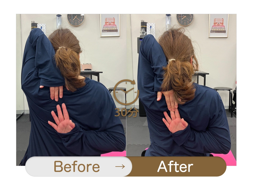 もみほぐし【肩こり/腰痛改善】リラクボディのビフォーアフター